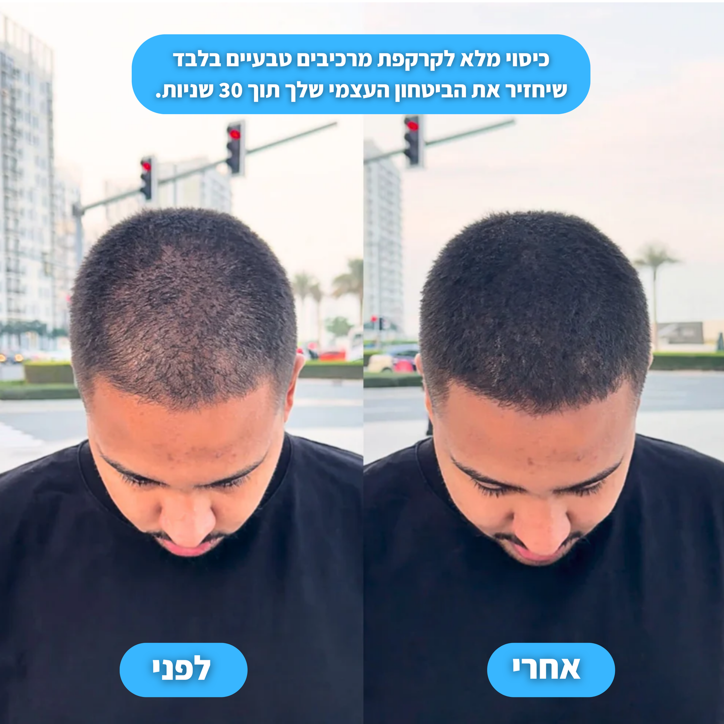 אבקת ההתקרחות של ונורו