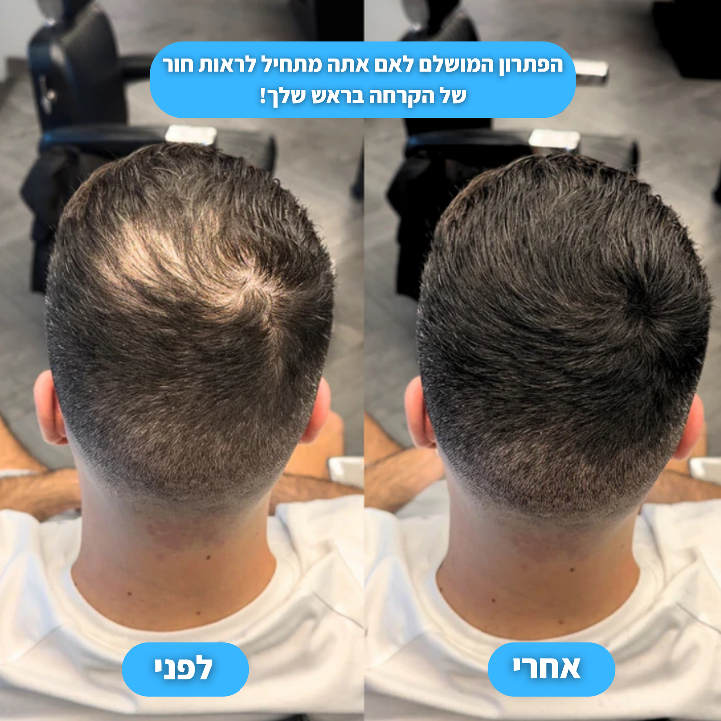 אבקת ההתקרחות של ונורו