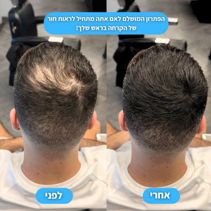 אבקת ההתקרחות של ונורו
